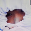 nugget_x1