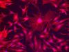 vimentin