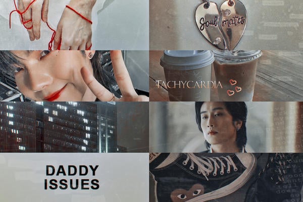 Tachycardia