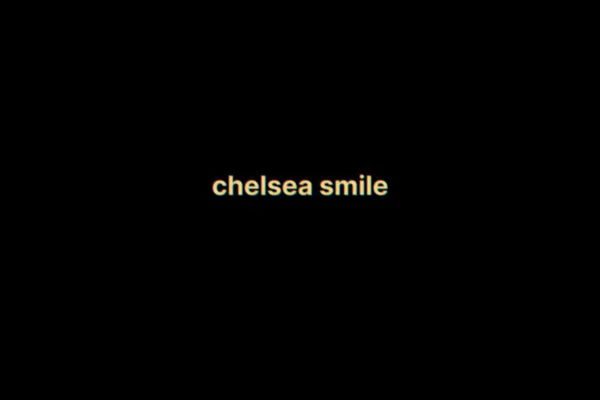 chelsea smile