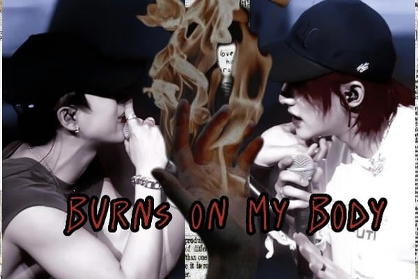 burns on my body